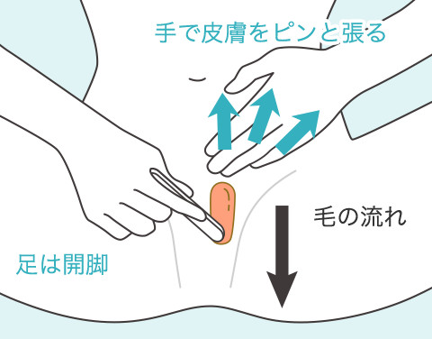 Iライン